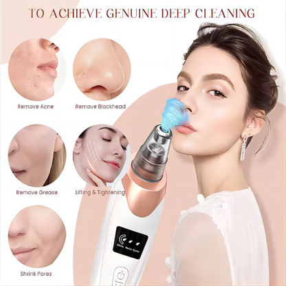 SkinLune™ ClarityGlow Vacuum (Deep Pores Cleanser)