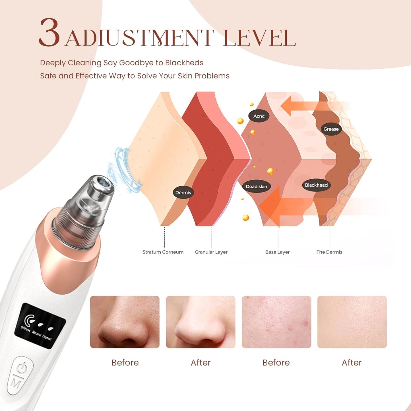 SkinLune™ ClarityGlow Vacuum (Deep Pores Cleanser)