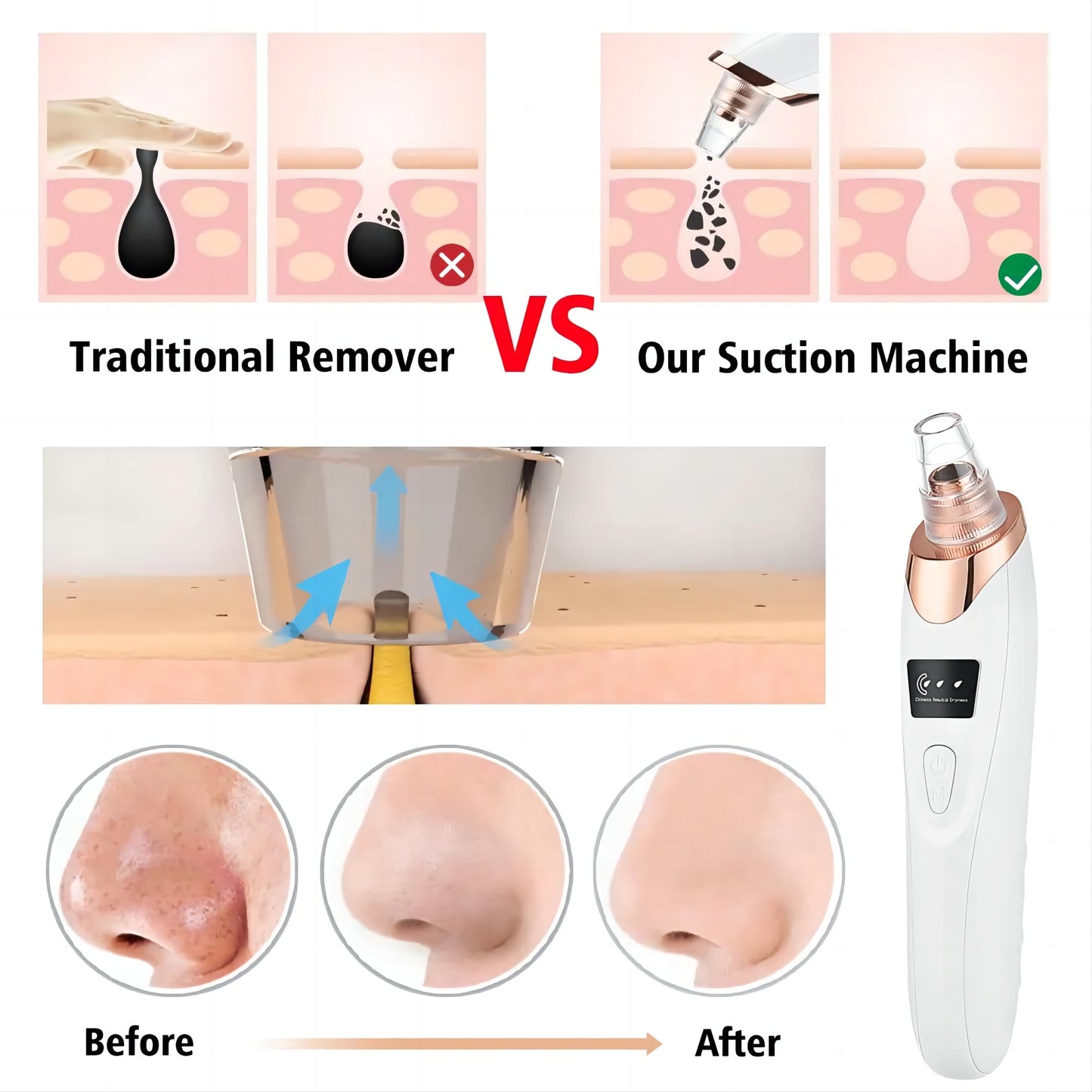SkinLune™ ClarityGlow Vacuum (Deep Pores Cleanser)