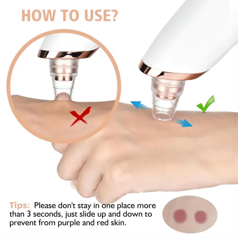 SkinLune™ ClarityGlow Vacuum (Deep Pores Cleanser)