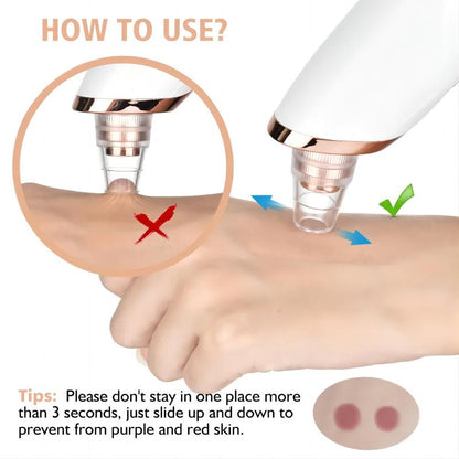 SkinLune™ ClarityGlow Vacuum (Deep Pores Cleanser)